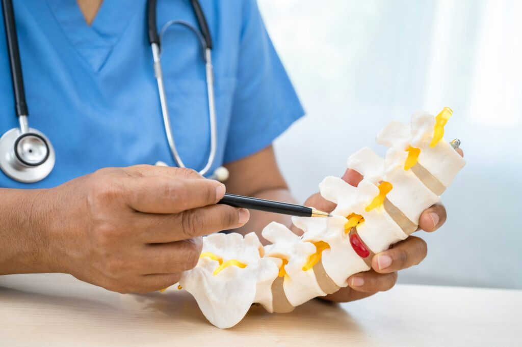 Doctor with lumbar vertebra bone skeleton and nerve model for treatment in the orthopedic